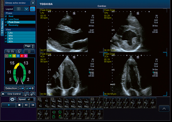 Tests - Private Heart Specialists - Hampshire Heart Specialists